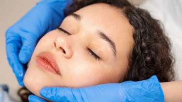 Microneedling With PRP