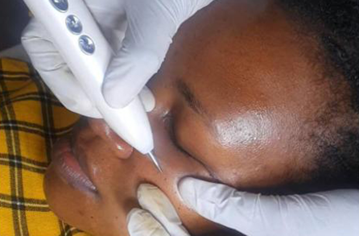 DPN & Skin Tag Removal Therapy